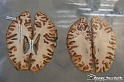 VBS_3013 - Materia grigia e bianca - Mostra Body Worlds